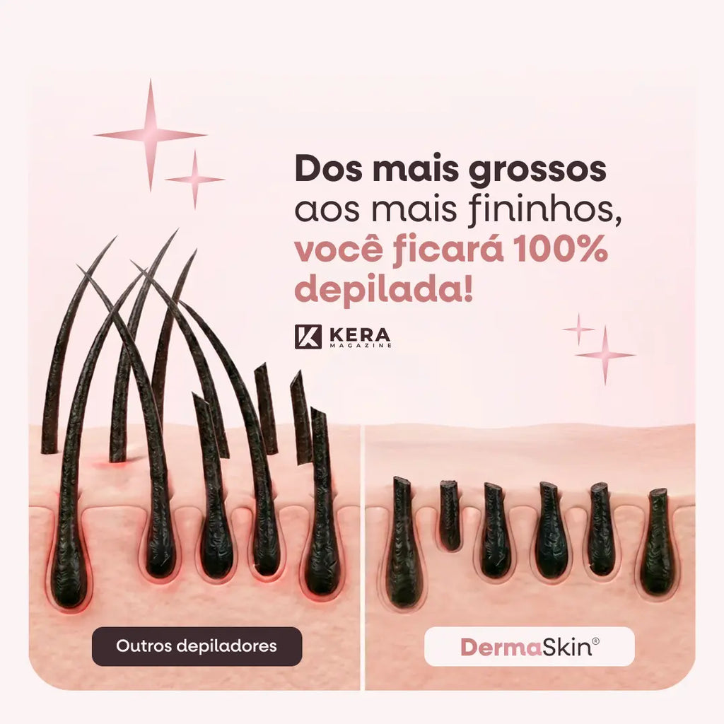 DermaSkin® - Depilador Elétrico 4 em 1 (Pele Lisa e Sem Irritações) - Frete Grátis!